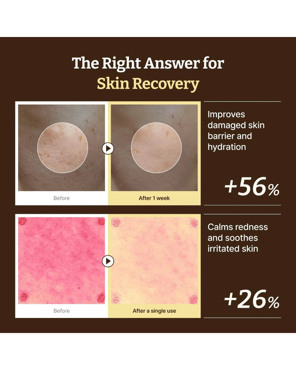 Dr. Reju-All Advanced PDRN Verjongende Crème