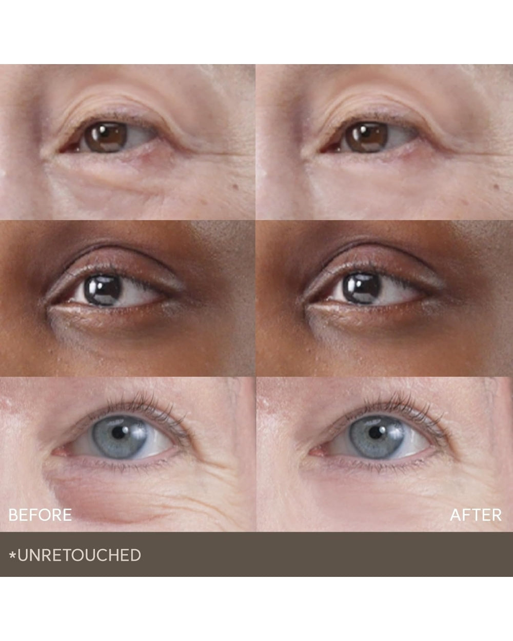 Marshique - Wrinkle Repair Hydrogel Eye Patch