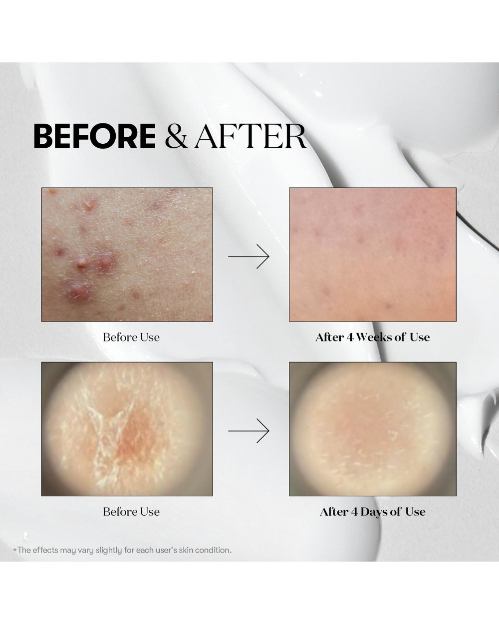 VT Cosmetics – Vita-Light Reedle Shot 300 Stick Pouch (10 x 2ml)