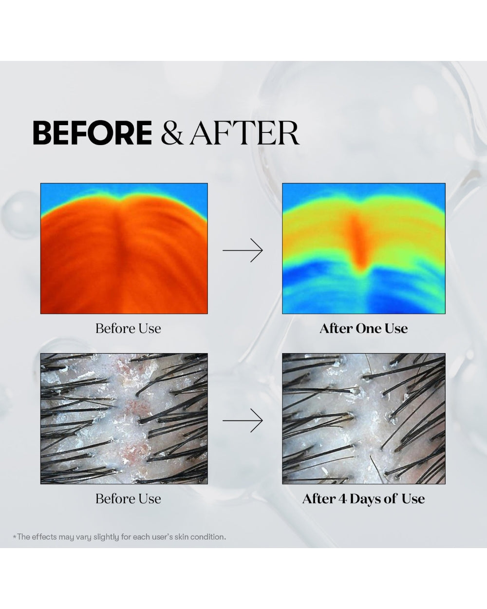 VT Cosmetics - PDRN Reedle Shot Hair Ampoule 300dl